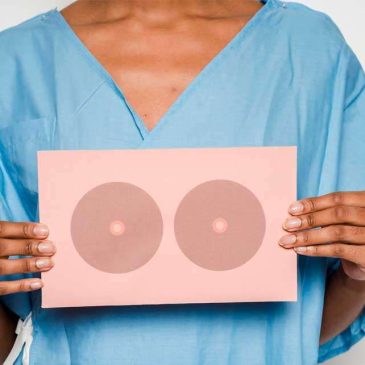 Cuidados no pós-mastectomia - Foto: Klaus Nielsen - Pexels